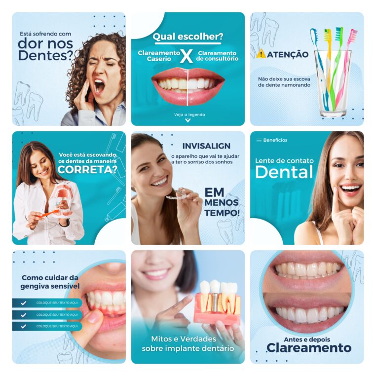 Pack Canva Dentista Odonto Template Canva 30 Artes + Bônus